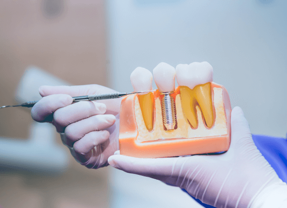 些細なことなんでもご相談ください!。長野県松本市女鳥羽の歯科・歯医者でインプラント治療なら平沼歯科医院へご相談を